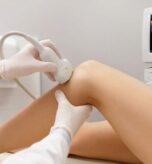 USG Doppler żył i tętnic kończyn dolnych kompletny przewodnik po badaniu
